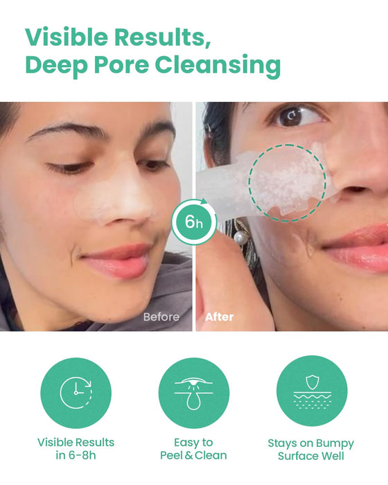GLAM UP Spotless Nose Patch Hydrocolloid Coverage for Nose Pores, Zits and Oil - Overnight Strong Waterproof to Absorb Blackheads & Pimple Nose Gunk, and Calm with Tea Tree (12 Patches)
